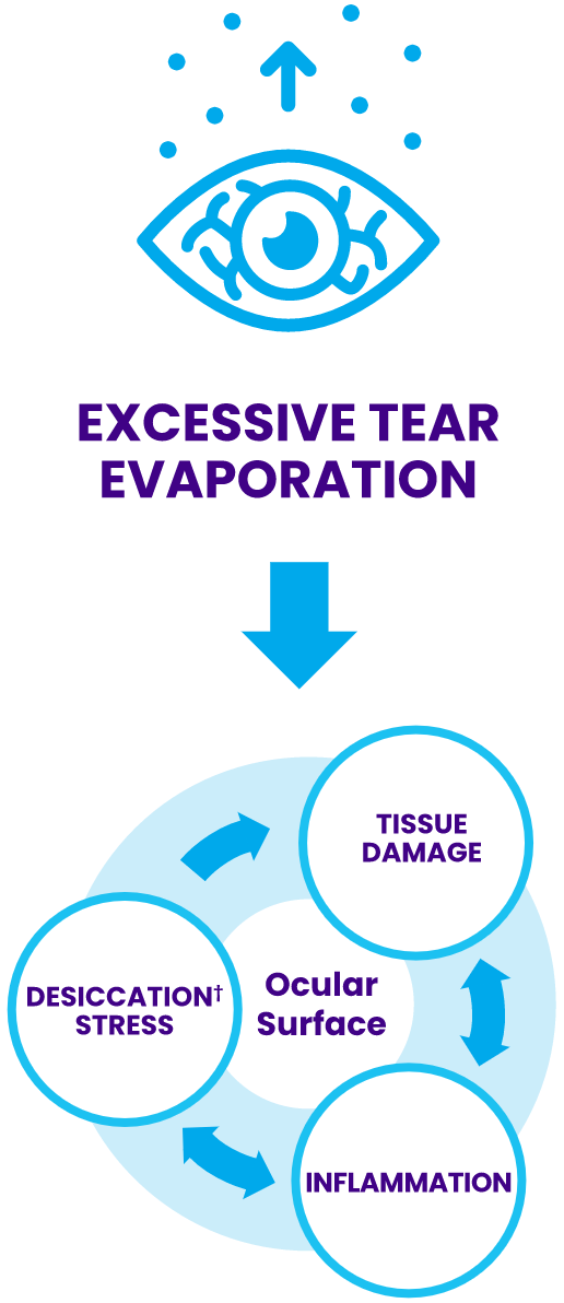 Cycle of dry eye disease illustration